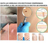 Herpes Genital Herpes Labial Verrugas Efectivo Y Definitivo 6