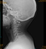 Radiografías A Domicilio 3