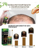 Tratamento De Calvície Cura Cabelo Calvo Freeshipping 3