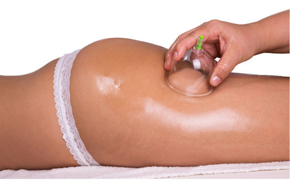 Criolipolisis  Plana 1