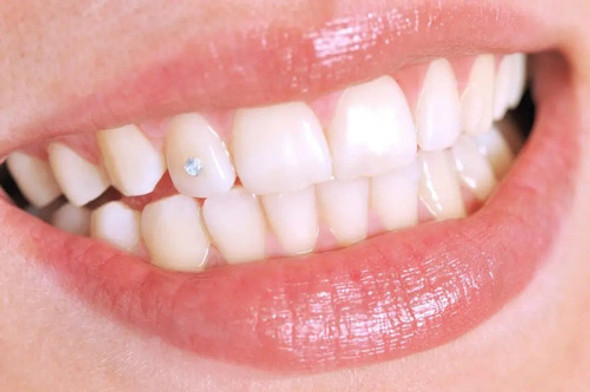 Colocacion Joyeria Dental  Crystales A Domicilio O Gabinete 0