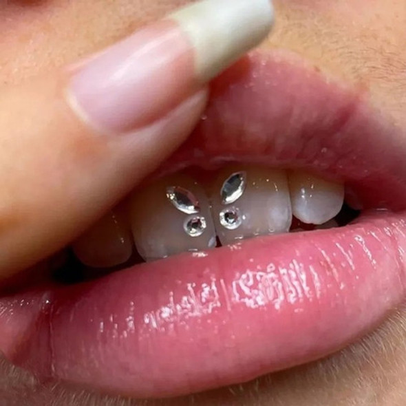 Colocacion Joyeria Dental  Crystales A Domicilio O Gabinete 1