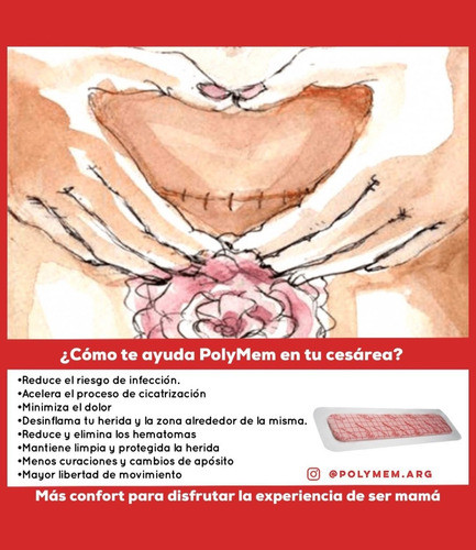 Pad De Cesárea . Polimem Max Con Film Adhesivo 1