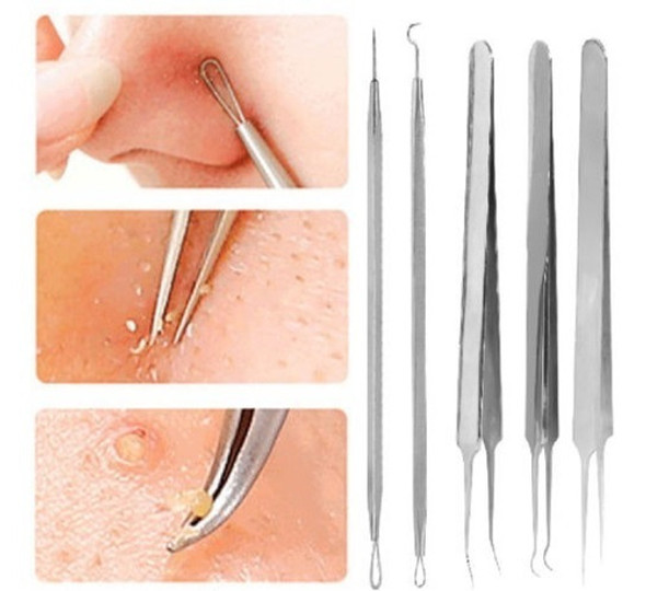 Sistema De Herramienta Del Removedor De Extractor De Comedon 0