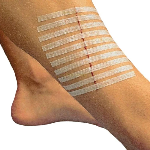 Suturas Adhesivas Tipo Steri Strip 6x100mm Sobre X10 Tiras 0
