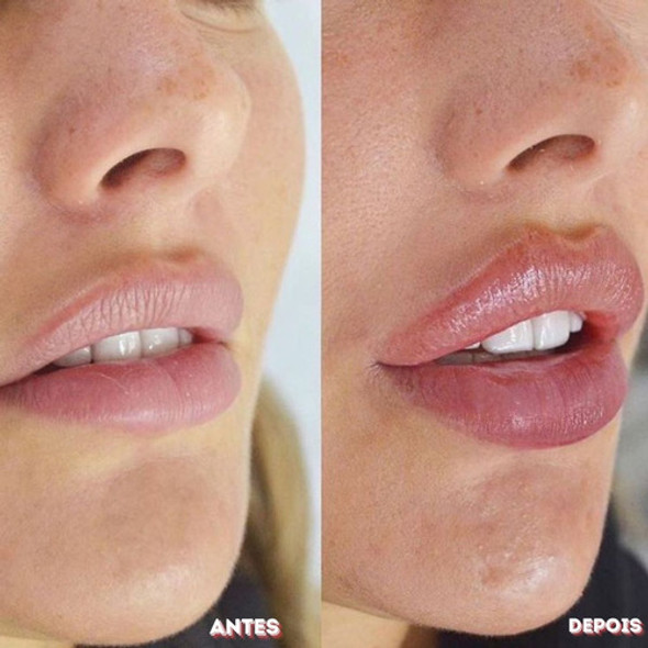 Esfoliante Labial Scrub Labotrat Dermo Skin Efeito Peeling 1