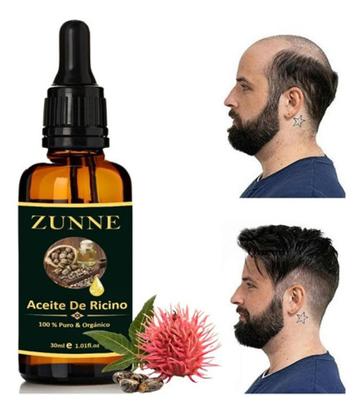 Aceite De Ricino Puro Y Orgánico/cuidado Del Pelo Y La Piel 0