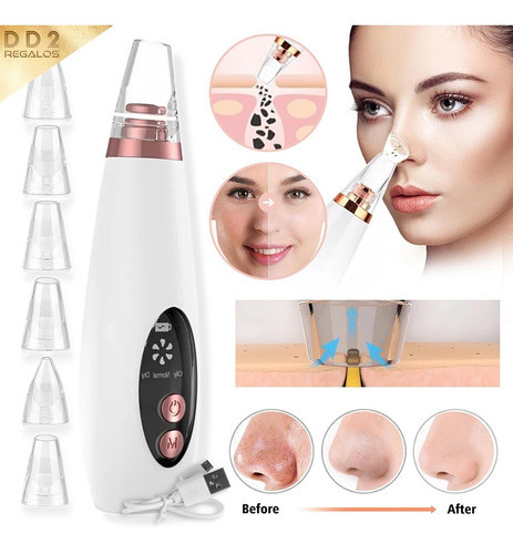 Removedor Extractor Puntos Negros Limpia Facial Recargable 1