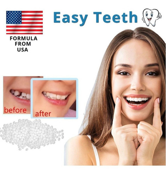 Reparacion Para Diente Relleno Provisorio Postizo Dental 1
