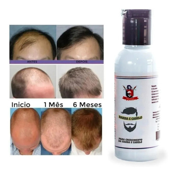 Crecimiento Del Cabello - Barba Unisex 1