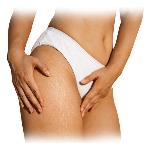 Curso Online - Camuflaje De Estrias + Certificado 0