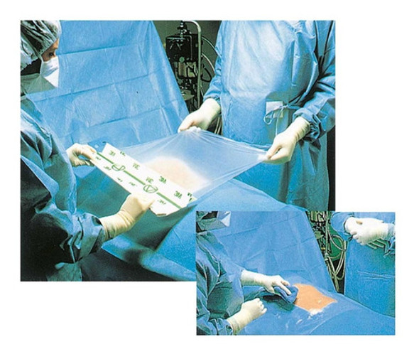 Campo Quirúrgico En U Surgical Drape 1015 Sd 120x130cm 1