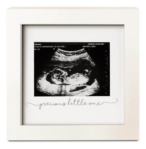 Marco Fotos Para Ecografía Bebé. Portarretratos. Blanco. 0