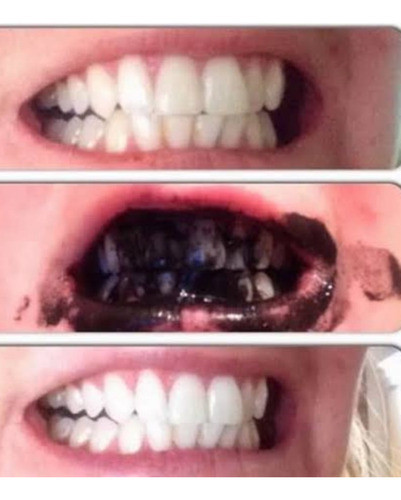 Clareador Dental Carvão Ativado 15g  - Atlântica Natural 1