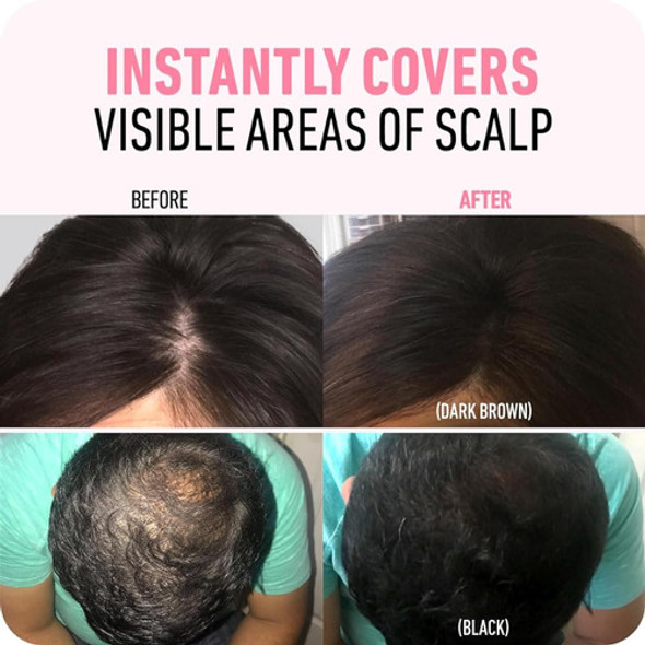 Boldify Hairline Powder (marrón Oscuro) Oculta Instantáneame 1
