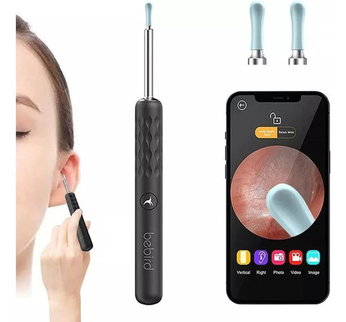 Limpiador Oido Otoscopio Inalámbrico Camara Hd 1