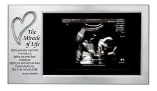 Miracle Of Life Babys First Photo Frame Sonogramultrasonido 0