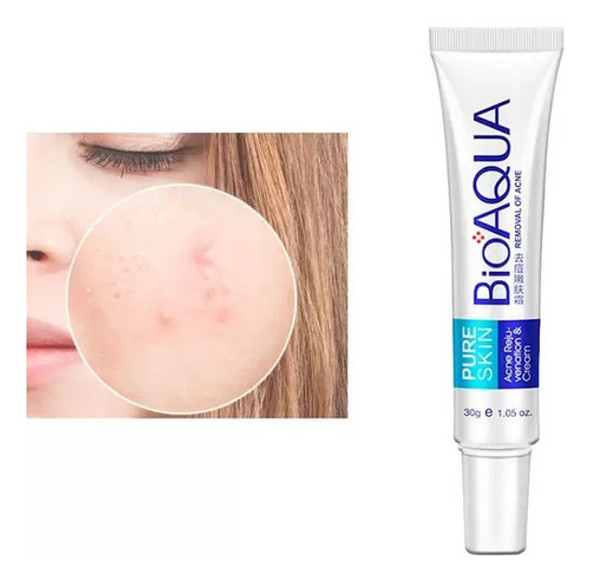 Bioaqua Creme Tratamento Para Acne E Remoção Cicatrizes 1