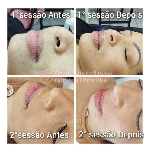 Sérum Rosa Hidragloss  Microagulhamento Labial Revitalizaçã 1
