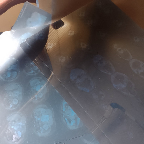 Radiografias Tomografias Usadas Lote X 50 0