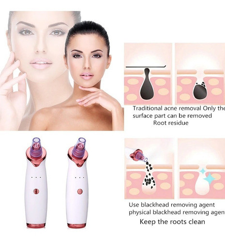 Limpiador Eliminador De Poros Espinillas Faciales Piel 1