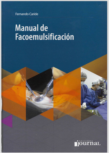 Manual Facoemulsificacion 0