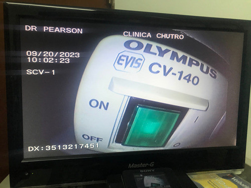 Torre Endoscopia Olympus Cv 140 0