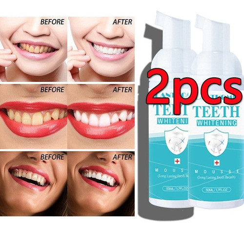 2 Peças De Mousse Clareadora De Dentes Lanthome Limpa A Boca 0