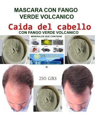 Mascara Caida Del Cabello Con El Mejor Activo Fango Verde 1