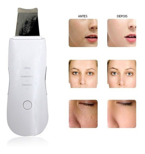 Limpiador Ultrasonico Exfoliante Facial Arruga Profesional 1