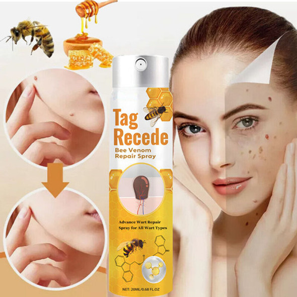 Creme Removedor De Verrugas Genitais 20 Ml* 2 Unidades 1