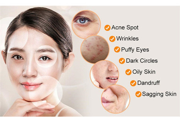 C/4 Eletrodos Portátil Aparelho Capilar De Alta Frequência 1 C/4 Eletrodos Portátil Aparelho Capilar De Alta Frequência 1