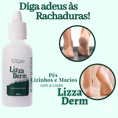 Lizzaderm Loção Para Os Pés 1