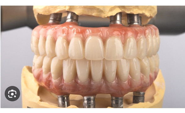 Acrílico New Poll Para Prótesis Dentales 1kg Resina Acrílica 1 Acrílico New Poll Para Prótesis Dentales 1kg Resina Acrílica 1
