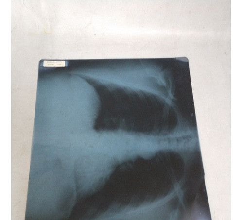 Placas Radiograficas Usadas Lote X43 Unidades 1