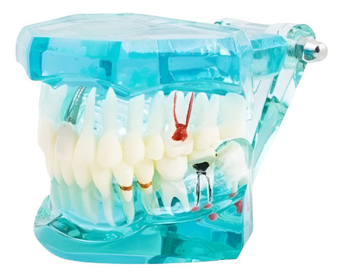 ¿tratar Enfermedades Transparente Modelo De Enseñanza De Die 0