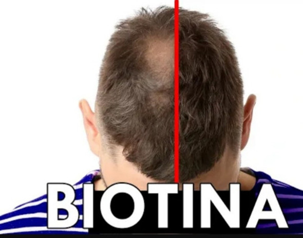 Tonico Capilar Biotina + Vitam Cabellos Mas Gruesos Y Largos 1 Tonico Capilar Biotina + Vitam Cabellos Mas Gruesos Y Largos 1