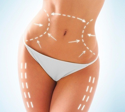 Crema Reductora, Anticelulitica & Drenante X 4 Kg 1