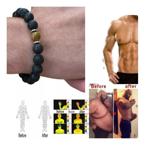 Pulsera Magnética Magnetoterapia Curativa Adelgaza Dolores 0