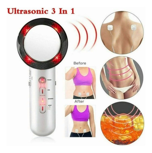 Dispositivo Estético De Lipocavitação Portátil Ultra-sônica 1