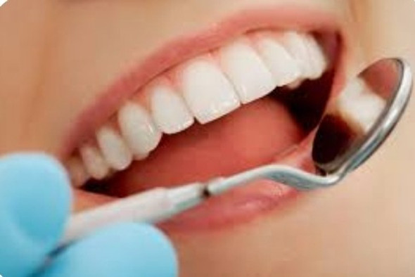 Limpieza Dental Con Ultrasonido - Remoción De Sarro 0