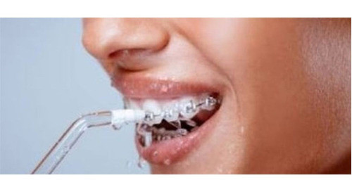 Hidro Lavador De Dientes Limpiador Bucal Inhalambrico 1