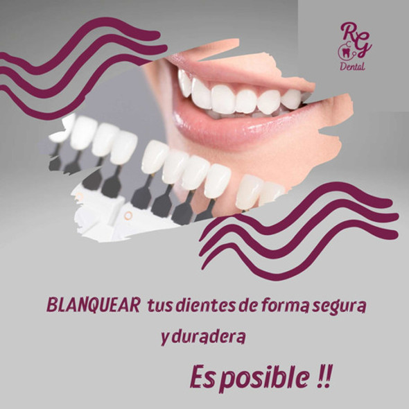 Blanqueamiento Dental 0