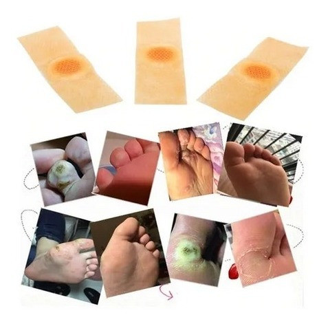 20 Banditas P Callos Acido Removedor Verrugas Ojo Gallo 1