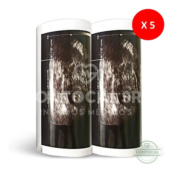 Caja X 5 Rollos Papel Video Printer Upp 110 S Ulstar 1 Caja X 5 Rollos Papel Video Printer Upp 110 S Ulstar 1