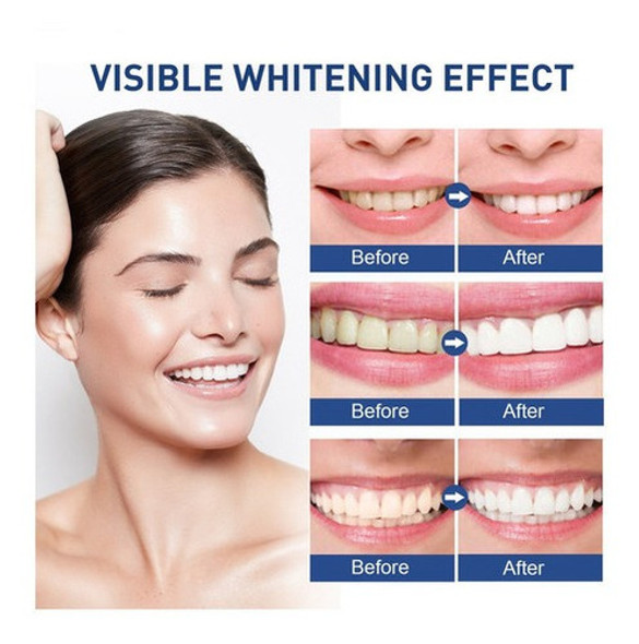 Tinta Branca Brilhante Para Higiene Bucal, Manchas De Dentes 1