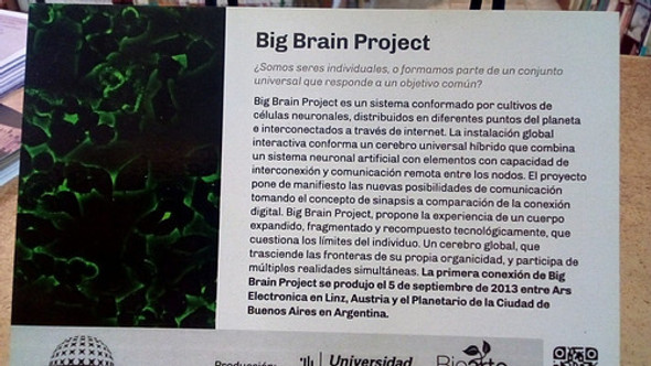 Big Brain Project. Joaquin Fargas. Postal. 15x10. 1