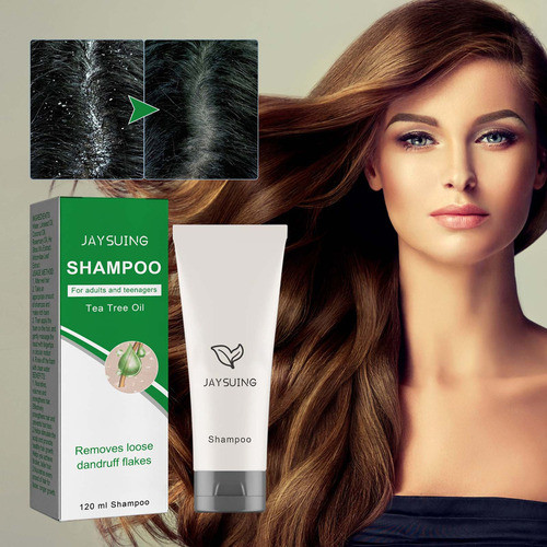 Dd Shampoo Para Limpeza Profunda Da Caspa, Aliviando A 1