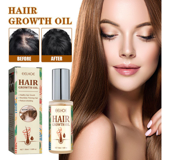 Biotina E Óleo De Rícino Para O Crescimento Do Cabelo - 50ml 1 Biotina E Óleo De Rícino Para O Crescimento Do Cabelo - 50ml 1