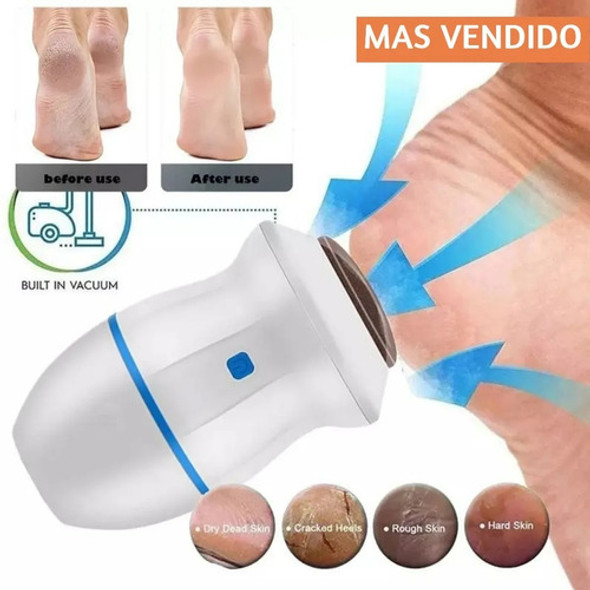 Removedor Eliminador De Callo Eléctrico Exfoliador Pie Mano 1